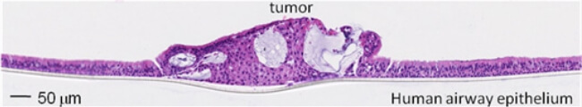 OncoCilAir™の典型的な組織学的切片