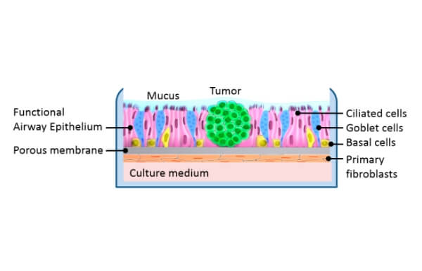 ヒト気道上皮肺癌モデル in vitro 3D再構成モデル OncocilAir